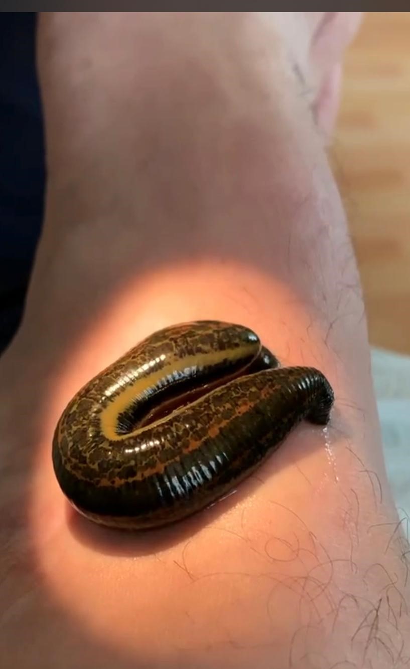 Blutegel-aktiv-am-Fuss_02 Blutegel-aktiv-am-Fuss_02